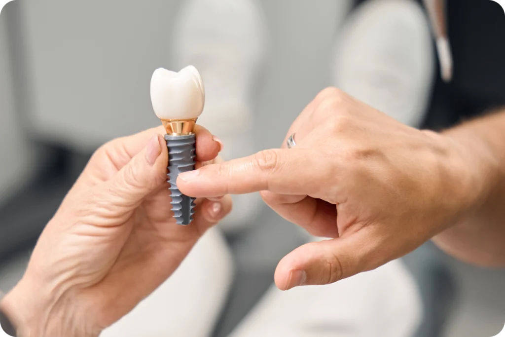 Expertise du praticien en chirurgie implantaire
